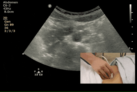 Advanced Ultrasound Course Abdominal and small parts